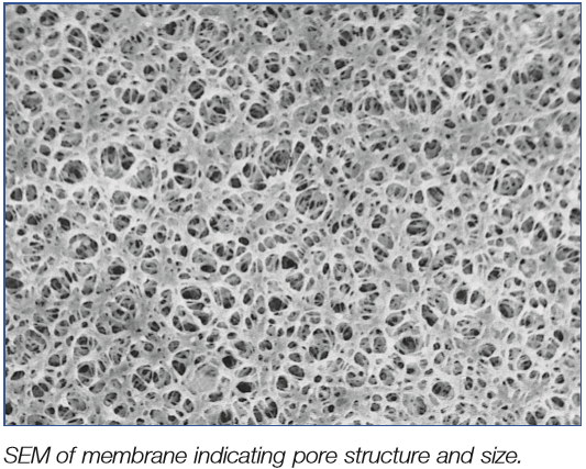 sem of membrane indicating pore structure and size